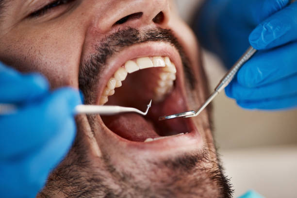 Best Emergency Treatment for Oral Infections in Red Lake, MN